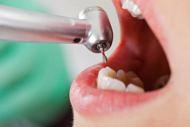 Best Cracked Tooth Emergency Dentist  in Alliance, OH